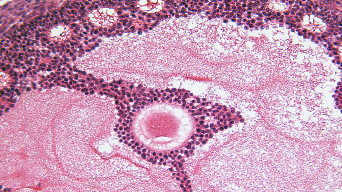 Microplásticos en el ovario: lo que la ciencia acaba de descubrir